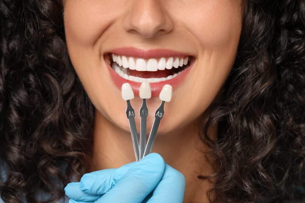 Dental Implants Gig Harbor